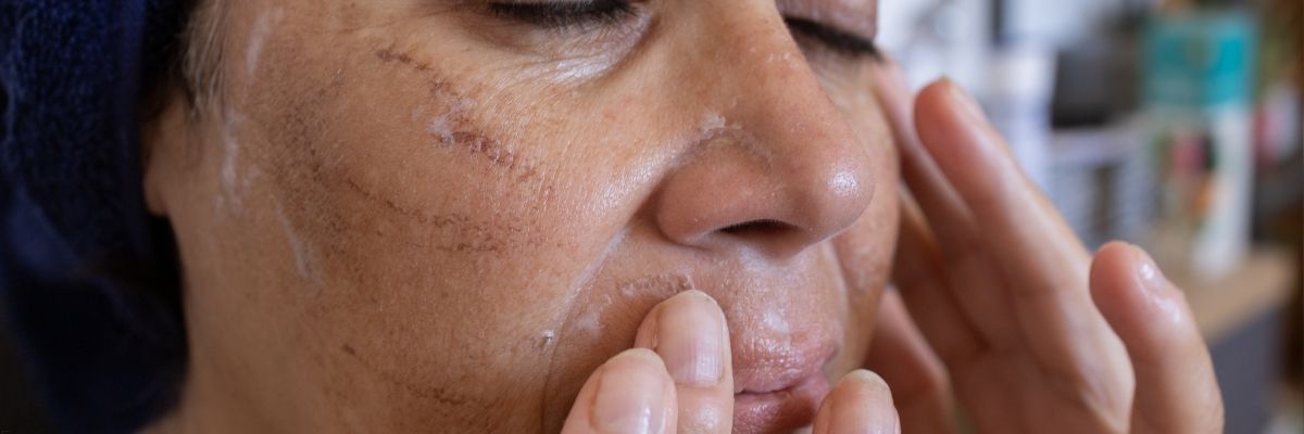 Cilt Asitleri Kullanım Rehberi