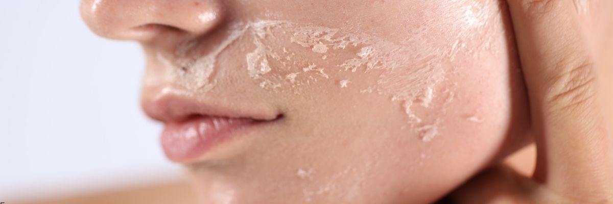 Hassas Cilt Minimal Rutin